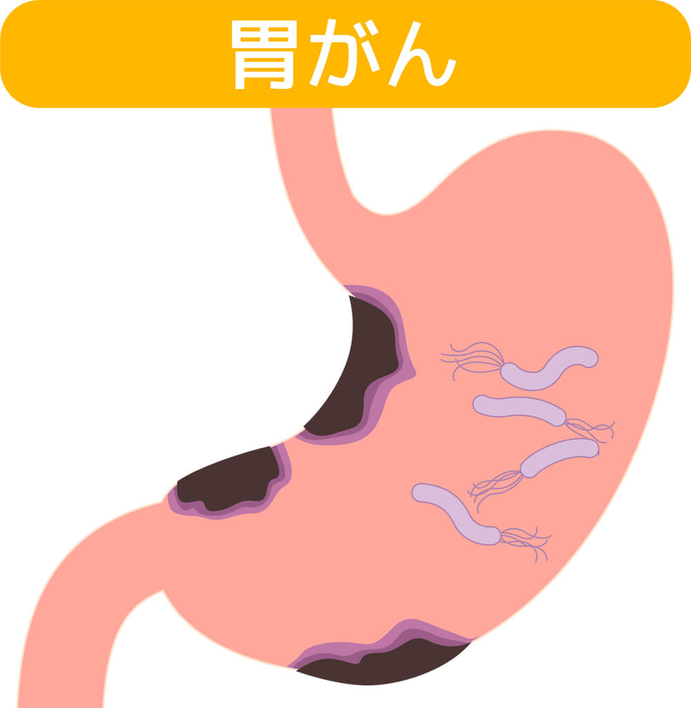 大阪府四條畷市で胃カメラなら四條畷市の きたいクリニック 苦しくない検査