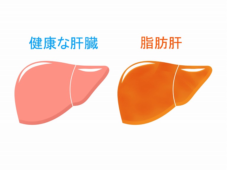 症状 ん 肝臓 が 初期 肝臓・胆のう・すい臓の病気の初期症状 [肝臓・すい臓・胆のうの病気]